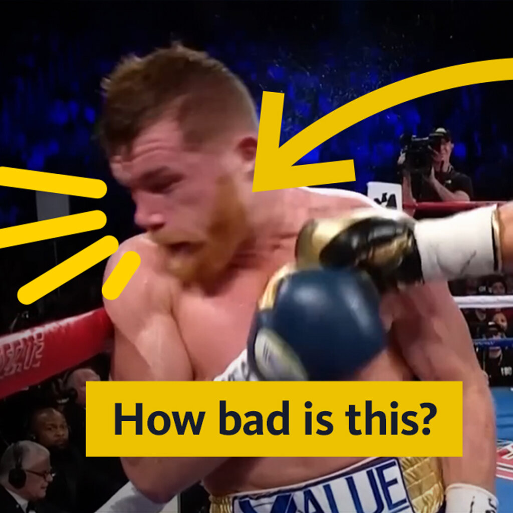 Photo of someone getting punched - "How bad is this?" 