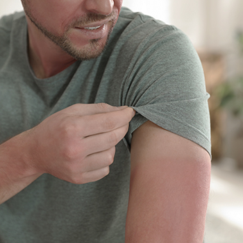 Man with sunburned skin at home, closeup