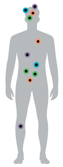 Graphic of body with dots representing the location of each physical condition in the bulleted list