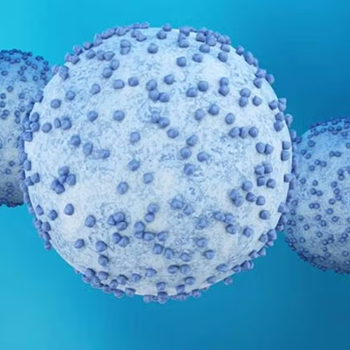 Pancreatic cancer cells